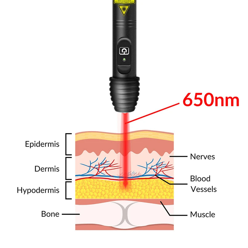 Rechargeable Cold Laser Therapy Device for Dogs. Muscle/Joint Pain Massage and Relaxation